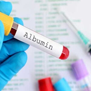 Albumin Untuk Stroke