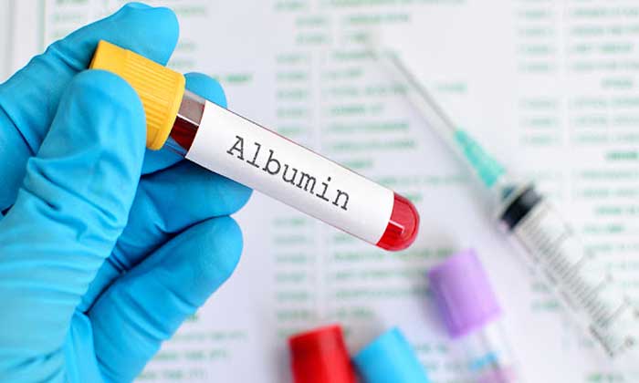 Albumin Untuk Stroke